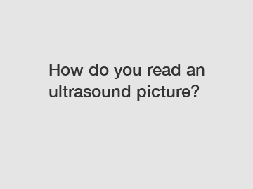 How do you read an ultrasound picture?